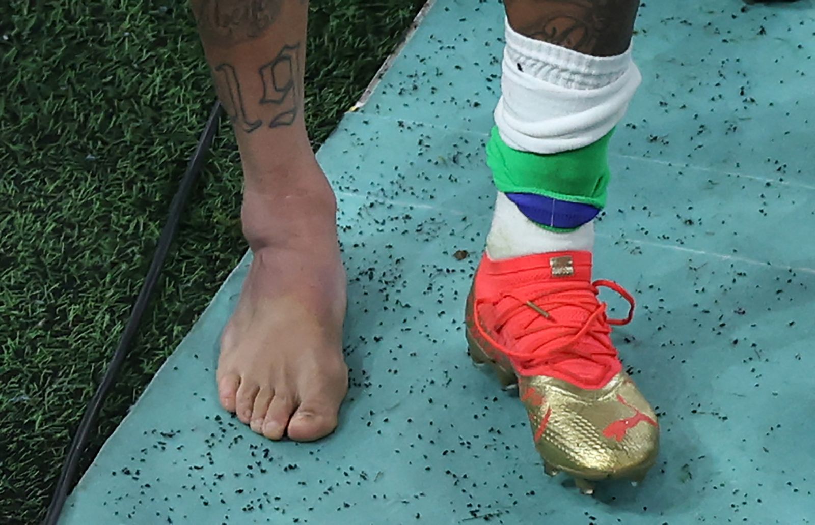 Como ficou o tornozelo de Neymar com a lesão